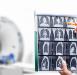 CT扫描图像肺