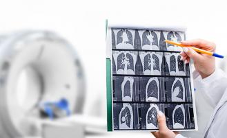 ct-scan-images-lungs